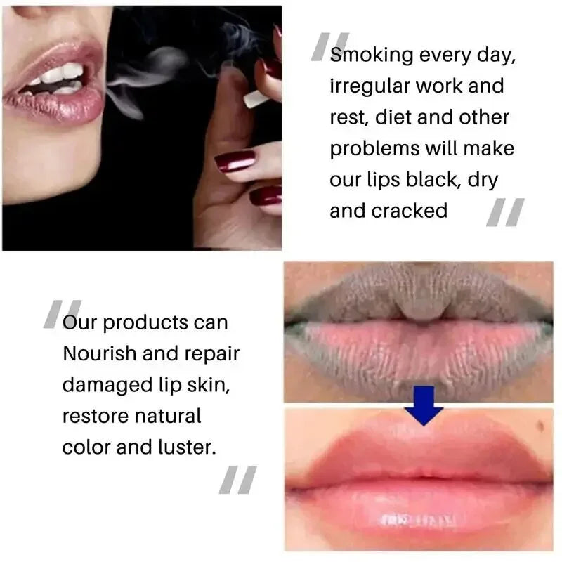 Lip Balm Whitening Remove Dark Lighten Melanin Lip Mask Fade Lip Line Brighten Exfoliating Moisturize Dead Skin Repair Lip Care