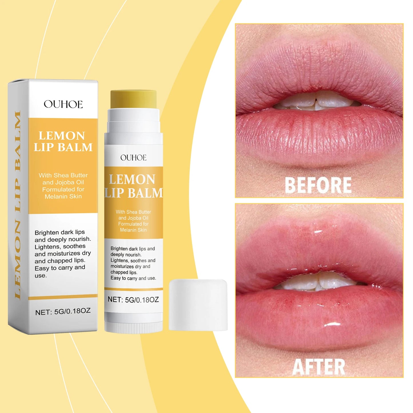 Ginger Lemon Lip Balm & Lip Mask – Exfoliating, Moisturizing, Turmeric-Based Care (5g / 10g)